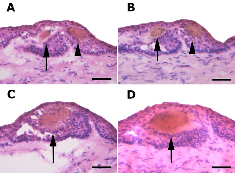 Fig 3 Acetylcholinesterase prestained sections of limbus demonstrating CNE (arrows and arrowheads) completely wrapped by LECs. Bar=50 μm (A–D) 21