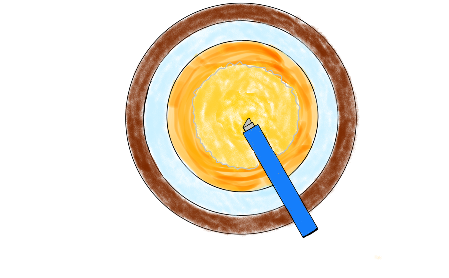 图1 吸除晶状体表层皮质及软壳