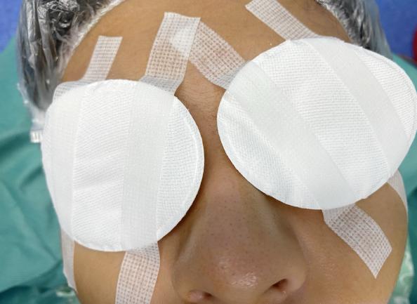 图1 双眼眼垫Figure 1 Binocular Eye Pads