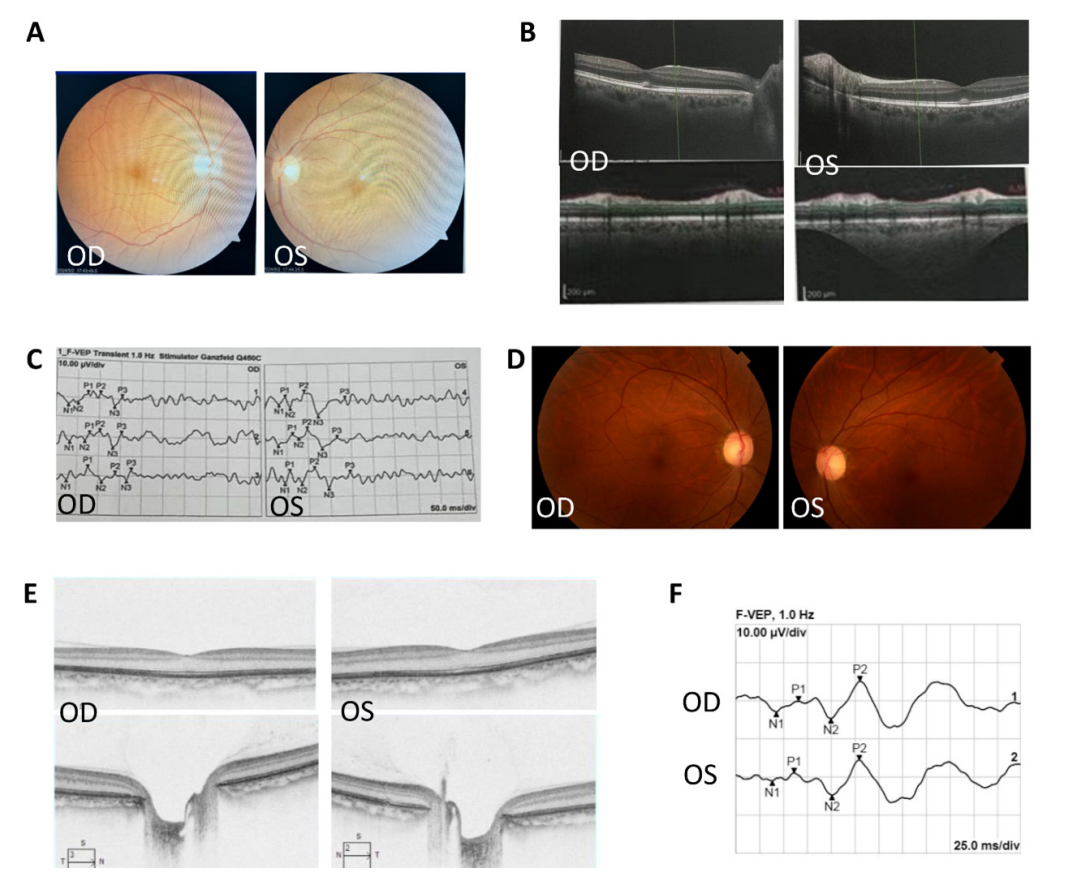 图 1 病例1图像 Figure 1 Images of case 1