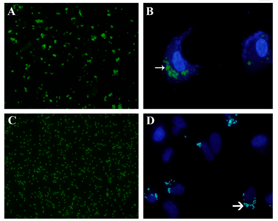 图2 FITC-POS和荧光微球及人RPE细胞的吞噬 Figure 2. Phagocytosis of FITC-POS and fluorescent microspheres by human RPE cells