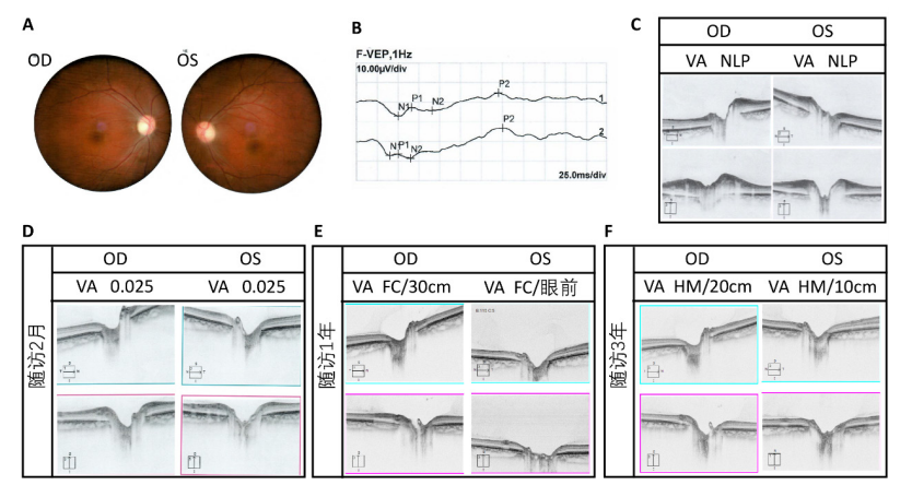补充图 1 病例9图像 Figure S1 Images of case 9
